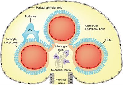 Basement Membrane Defects in Genetic Kidney Diseases